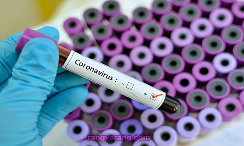 تشخیص درباره کرونا ویروس کووید ۱۹ 